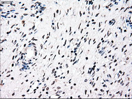 Immunohistochemical staining of paraffin-embedded Human Ovary tissue within the normal limits using anti-NRBP1 mouse monoclonal antibody