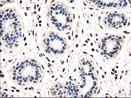 m07309 1 anti madm nrbp1 mouse monoclonal antibody clone id oti7c5 ihc testing 4