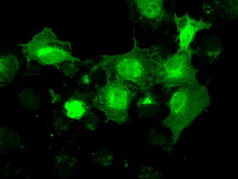 m07309 anti madm nrbp1 mouse monoclonal antibody clone id oti5c3 if testing 13