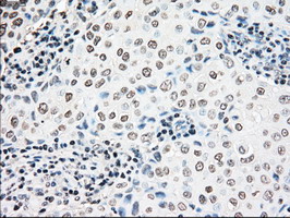 m07309 anti madm nrbp1 mouse monoclonal antibody clone id oti5c3 ihc testing 10