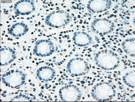 m07309 anti madm nrbp1 mouse monoclonal antibody clone id oti5c3 ihc testing 11