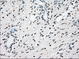 Immunohistochemical staining of paraffin-embedded Human Ovary tissue within the normal limits using anti-NRBP1 mouse monoclonal antibody