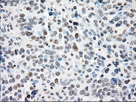 m07309 anti madm nrbp1 mouse monoclonal antibody clone id oti5c3 ihc testing 4