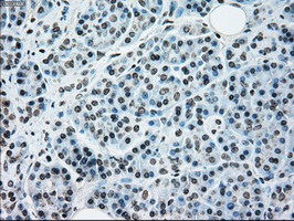 m07309 anti madm nrbp1 mouse monoclonal antibody clone id oti5c3 ihc testing 5