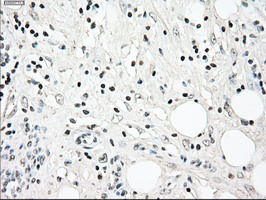 m07309 anti madm nrbp1 mouse monoclonal antibody clone id oti5c3 ihc testing 6