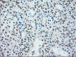 m07309 anti madm nrbp1 mouse monoclonal antibody clone id oti5c3 ihc testing 7
