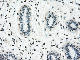 m07309 anti madm nrbp1 mouse monoclonal antibody clone id oti5c3 ihc testing 8