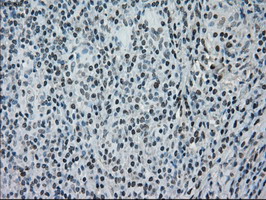 m07309 anti madm nrbp1 mouse monoclonal antibody clone id oti5c3 ihc testing 9