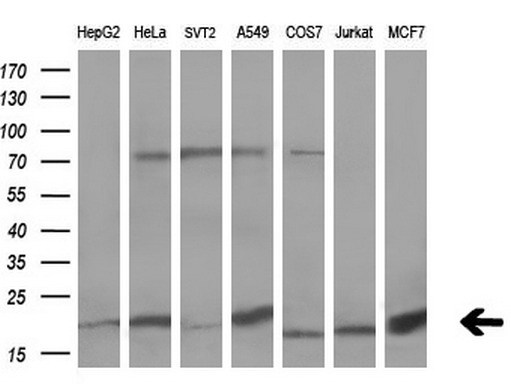 Western blot analysis of extracts (10ug) from 7 different cell lines by using anti-UBL4A monoclonal antibody (1:200)