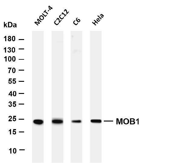 Various whole cell lysates were separated by 4-20% SDS-PAGE, and the membrane was blotted with anti-MOB1 antibody