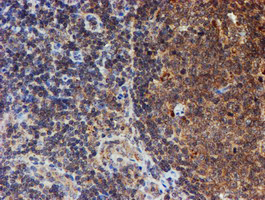m07330 anti hars2 mouse monoclonal antibody clone id oti5h2 ihc testing 11