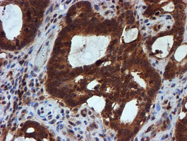 m07330 anti hars2 mouse monoclonal antibody clone id oti5h2 ihc testing 12