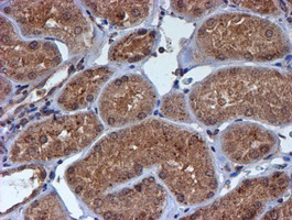 m07330 anti hars2 mouse monoclonal antibody clone id oti5h2 ihc testing 13