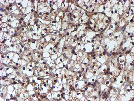 m07330 anti hars2 mouse monoclonal antibody clone id oti5h2 ihc testing 14