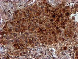 m07330 anti hars2 mouse monoclonal antibody clone id oti5h2 ihc testing 3