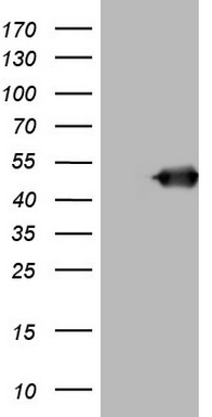 HEK293T cells were transfected with the pCMV6-ENTRY control (Left lane) or pCMV6-ENTRY BNIP2 (Right lane) cDNA for 48 hrs and lysed