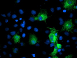 m07337 1 anti pfkp mouse monoclonal antibody clone id oti1f2 if testing 17