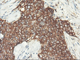 m07337 1 anti pfkp mouse monoclonal antibody clone id oti1f2 ihc testing 11