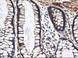 m07337 1 anti pfkp mouse monoclonal antibody clone id oti1f2 ihc testing 12