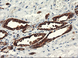 m07337 1 anti pfkp mouse monoclonal antibody clone id oti1f2 ihc testing 13