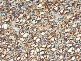 m07337 1 anti pfkp mouse monoclonal antibody clone id oti1f2 ihc testing 14