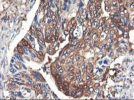 m07337 1 anti pfkp mouse monoclonal antibody clone id oti1f2 ihc testing 5