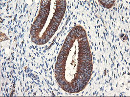m07337 1 anti pfkp mouse monoclonal antibody clone id oti1f2 ihc testing 6