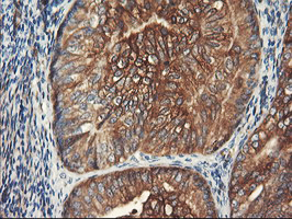 m07337 1 anti pfkp mouse monoclonal antibody clone id oti1f2 ihc testing 7