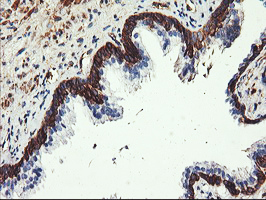 m07337 1 anti pfkp mouse monoclonal antibody clone id oti1f2 ihc testing 8