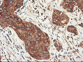 m07337 1 anti pfkp mouse monoclonal antibody clone id oti1f2 ihc testing 9
