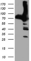 HEK293T cells were transfected with the pCMV6-ENTRY control (Left lane) or pCMV6-ENTRY PFKP (Right lane) cDNA for 48 hrs and lysed