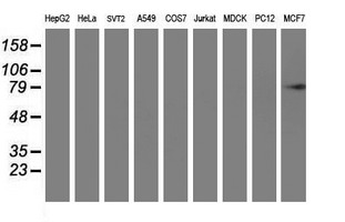 Western blot analysis of extracts (35ug) from 9 different cell lines by using anti-PFKP monoclonal antibody