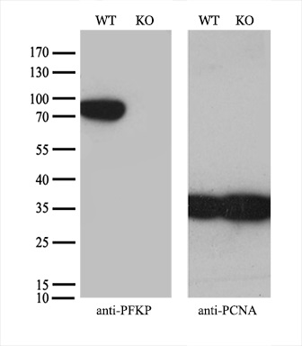 m07337 1 anti pfkp mouse monoclonal antibody clone id oti1f2 wb testing 3