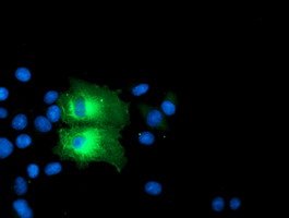 m07337 2 anti pfkp mouse monoclonal antibody clone id oti1d6 if testing 14