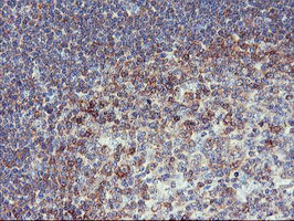 m07337 2 anti pfkp mouse monoclonal antibody clone id oti1d6 ihc testing 10