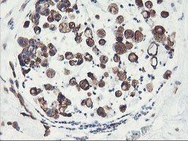 m07337 2 anti pfkp mouse monoclonal antibody clone id oti1d6 ihc testing 11