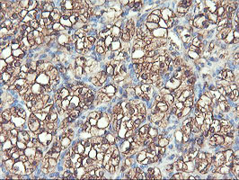 m07337 2 anti pfkp mouse monoclonal antibody clone id oti1d6 ihc testing 12