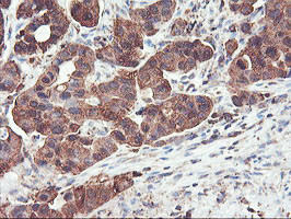 m07337 2 anti pfkp mouse monoclonal antibody clone id oti1d6 ihc testing 5