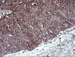 m07337 2 anti pfkp mouse monoclonal antibody clone id oti1d6 ihc testing 6