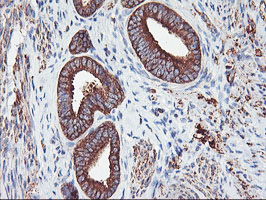m07337 2 anti pfkp mouse monoclonal antibody clone id oti1d6 ihc testing 7
