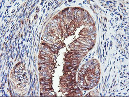 m07337 2 anti pfkp mouse monoclonal antibody clone id oti1d6 ihc testing 8