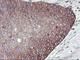 m07337 2 anti pfkp mouse monoclonal antibody clone id oti1d6 ihc testing 9