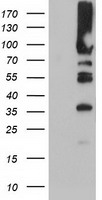 HEK293T cells were transfected with the pCMV6-ENTRY control (Left lane) or pCMV6-ENTRY PFKP (Right lane) cDNA for 48 hrs and lysed