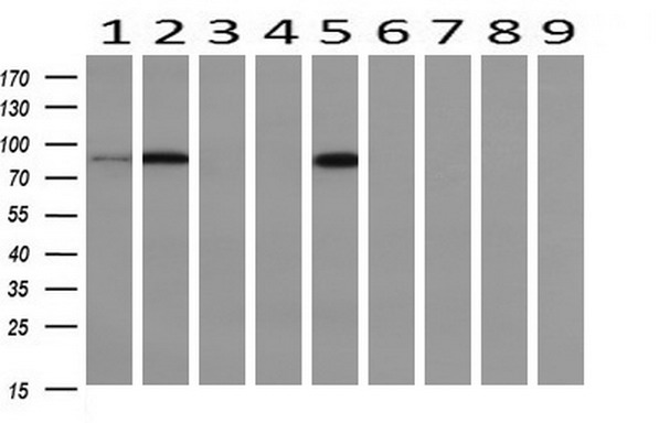 Western blot analysis of extracts (10ug) from 9 Human tissue by using anti-PFKP monoclonal antibody at 1:200 (1: Testis; 2: Omentum; 3: Uterus; 4: Breast; 5: Brain; 6: Liver; 7: Ovary; 8: Thyroid gland; 9: colon)
