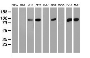 Western blot analysis of extracts (35ug) from 9 different cell lines by using anti-PFKP monoclonal antibody