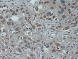 m07349 anti hnf6 onecut1 mouse monoclonal antibody clone id oti4f12 ihc testing 2