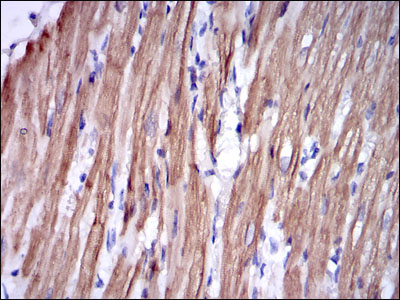 m07355 tnni2 primary antibodies ihc testing 3