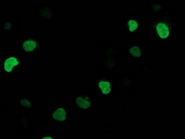m07363 anti ssx1 mouse monoclonal antibody clone id oti2f8 if testing 11