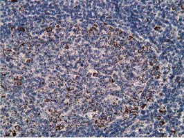 m07363 anti ssx1 mouse monoclonal antibody clone id oti2f8 ihc testing 4