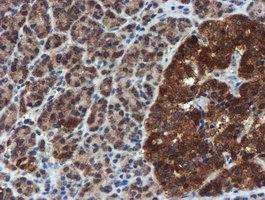 m07379 anti xtp4 mien1 mouse monoclonal antibody clone id oti2d2 ihc testing 4